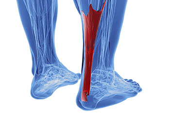 achilles tendon treatment in the Monmouth County, NJ: Little Silver (Long Branch, Tinton Falls, Asbury Park, Eatontown, Red Bank, Keansburg) and New York County, NY: New York, as well as Hudson County, NJ: Jersey City, Hoboken, Union City, West New York, Secaucus areas