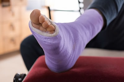 foot and ankle fractures treatment in the Monmouth County, NJ: Little Silver (Long Branch, Tinton Falls, Asbury Park, Eatontown, Red Bank, Keansburg) and New York County, NY: New York, as well as Hudson County, NJ: Jersey City, Hoboken, Union City, West New York, Secaucus areas