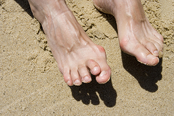 hammertoe treatment in the Monmouth County, NJ: Little Silver (Long Branch, Tinton Falls, Asbury Park, Eatontown, Red Bank, Keansburg) and New York County, NY: New York, as well as Hudson County, NJ: Jersey City, Hoboken, Union City, West New York, Secaucus areas