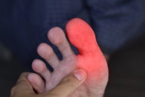 Complex Regional Pain Syndrome of the Big Toe